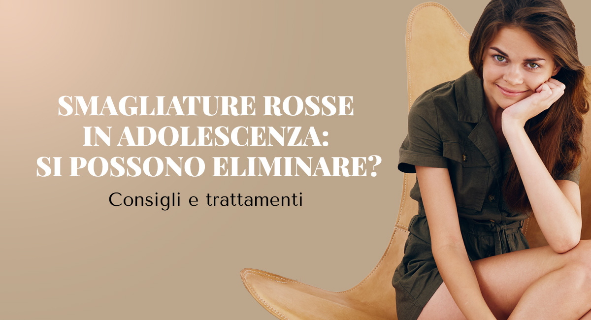 smagliature adolescenza